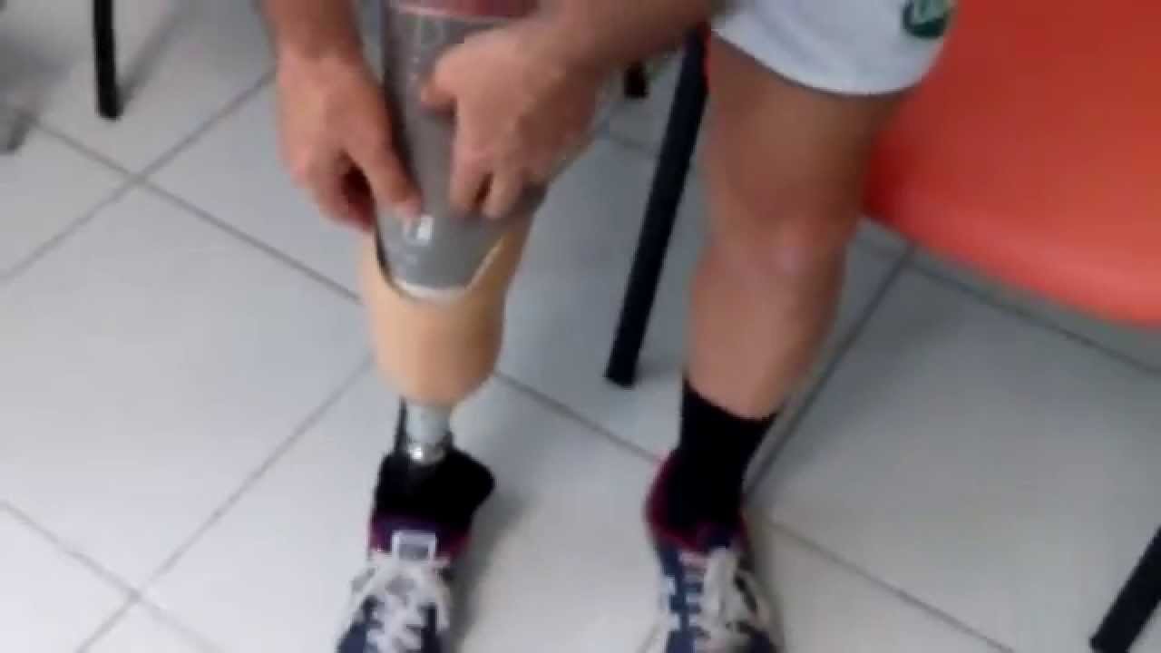 protesi